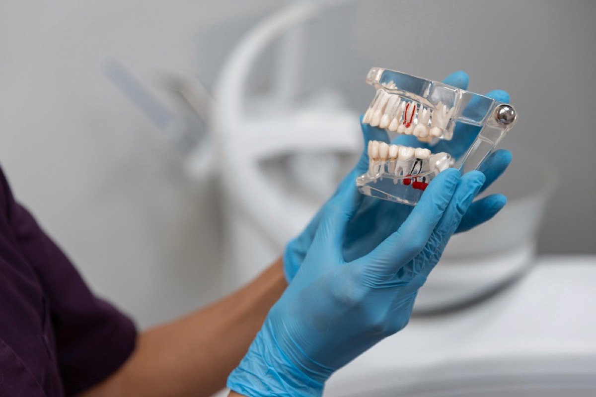 Implantate – Dentallabor Ekkert