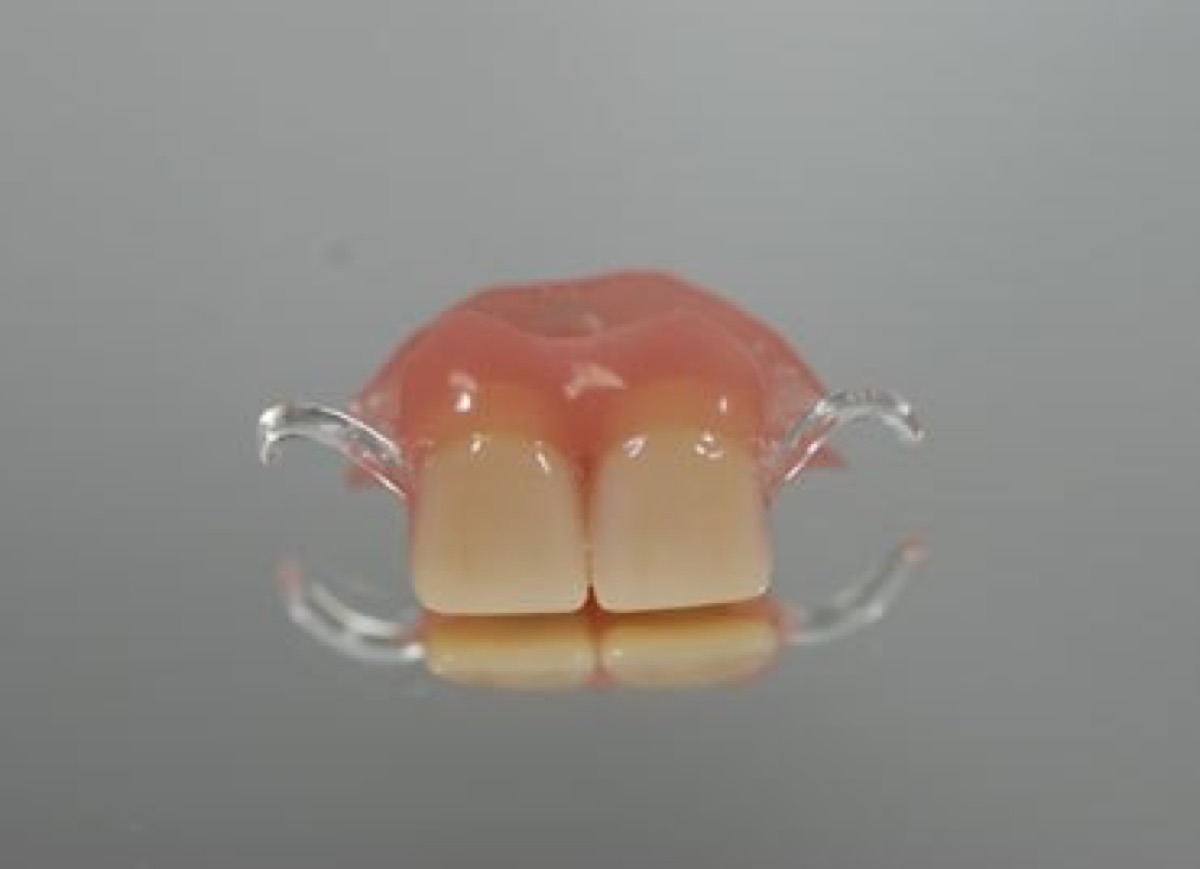Klammerprothese – Dentallabor Ekkert