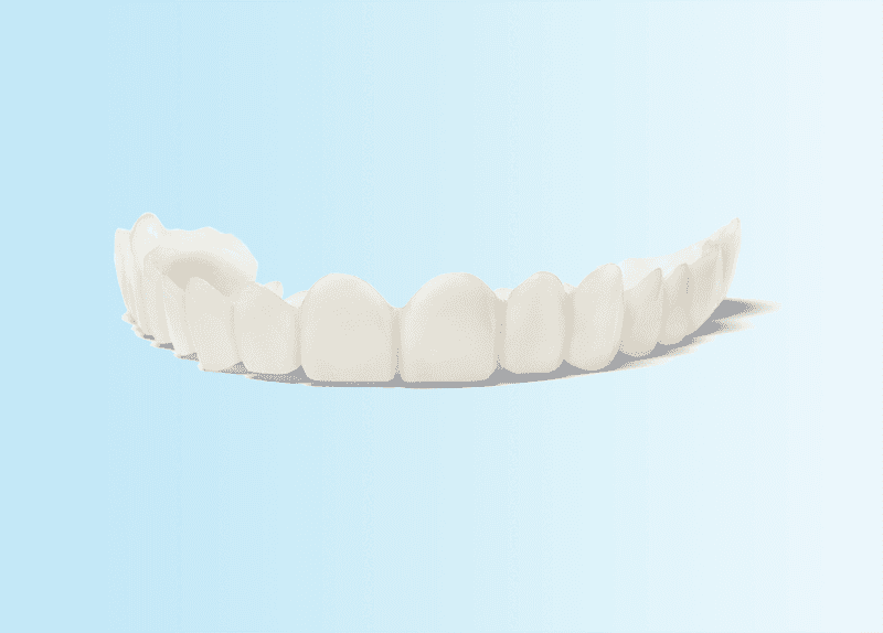 Hollywood-Schönheitsschiene – Dentallabor Ekkert
